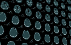 morphology scans
