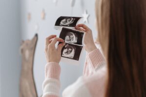 Twin Pregnancies