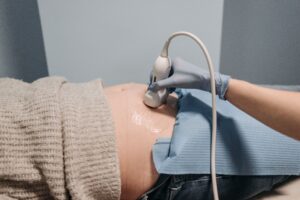 CVS vs Amniocentesis gold coast